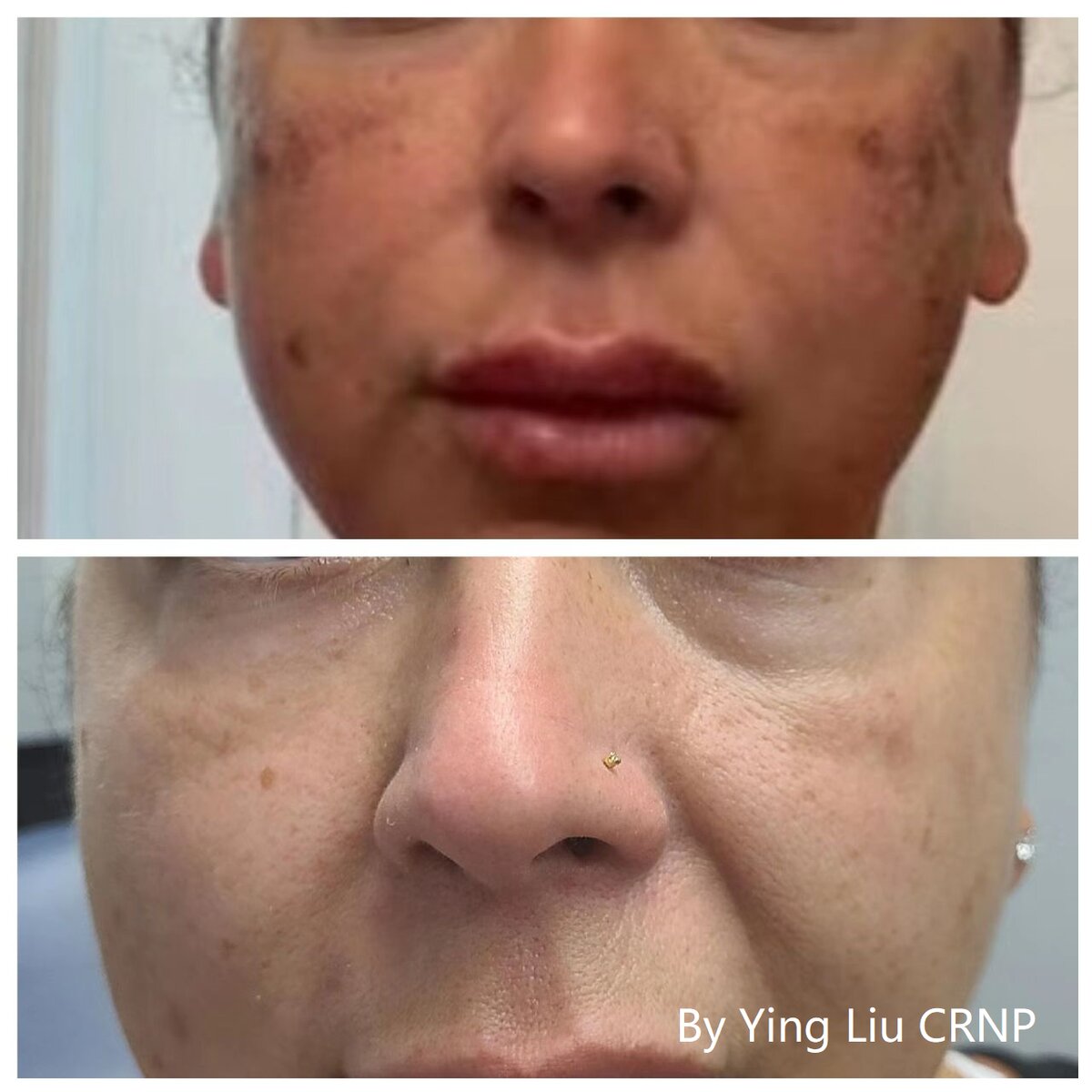 Before-After-YingLiu-2